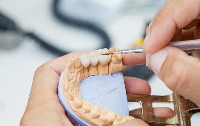 Closeup of dentist working on model of dental bridge