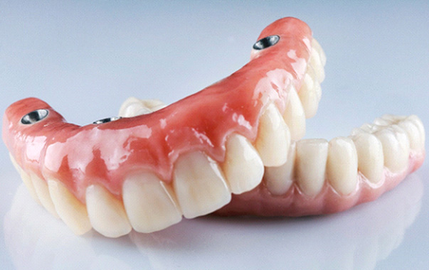 Two implant dentures in Spring Hill, TN on table