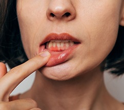 Woman with gum irritation
