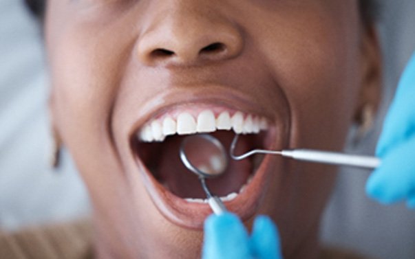 Dentist using tools to examine patients teeth