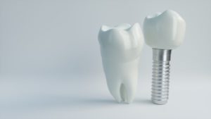 dental implant in Spring Hill next to natural tooth 
