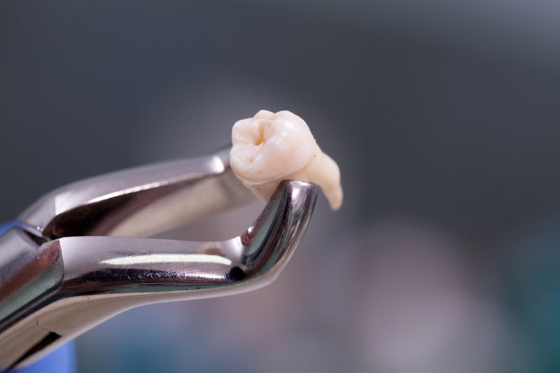 A closeup of an extracted tooth held by dental forceps